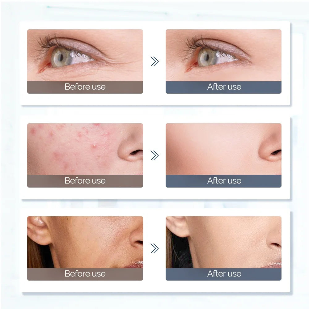 Glowva Skin Reset LED Mask