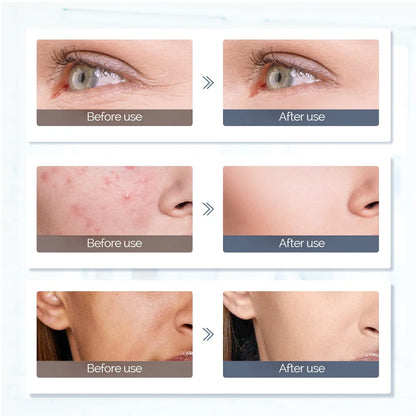 Glowva Skin Reset LED Mask
